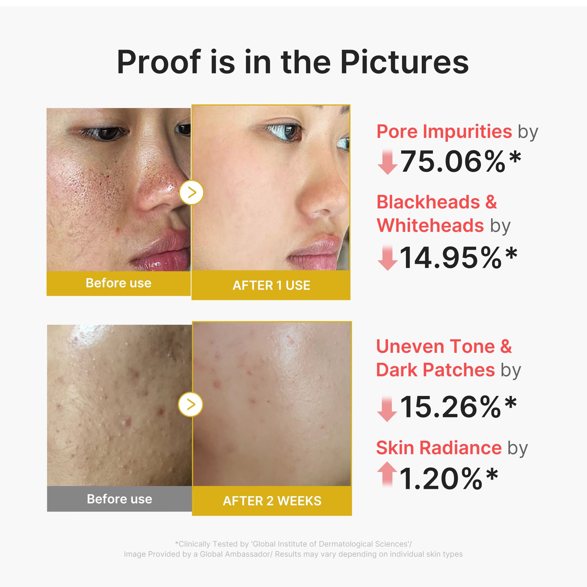 Kojic Acid Turmeric Peel Shot - medicube.us