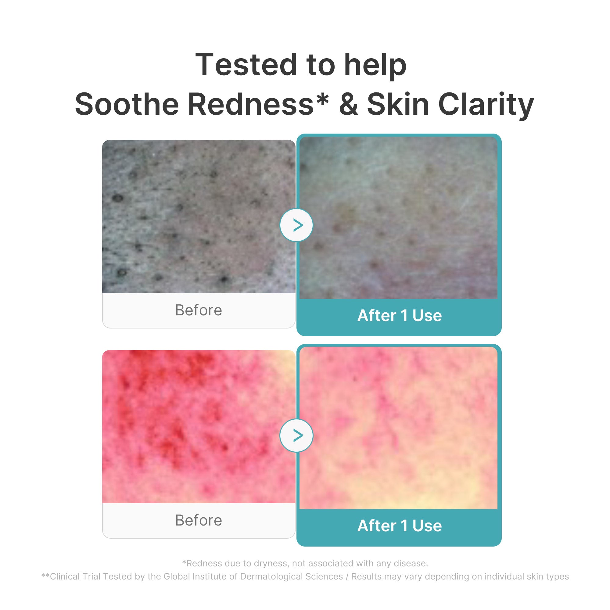Azelaic Acid Capsule Foam Cleanser - medicube.us