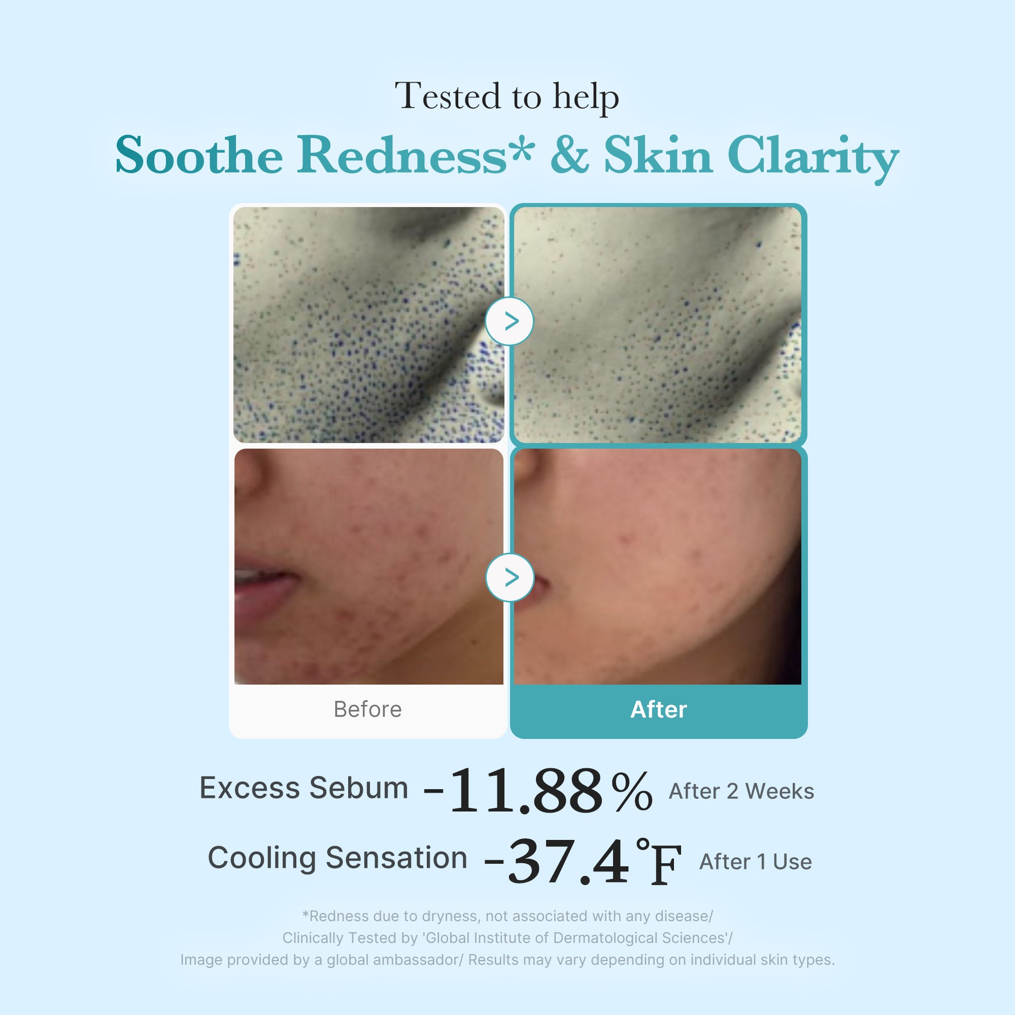 Azelaic Acid Niacinamide Clarifying Toner - medicube.us