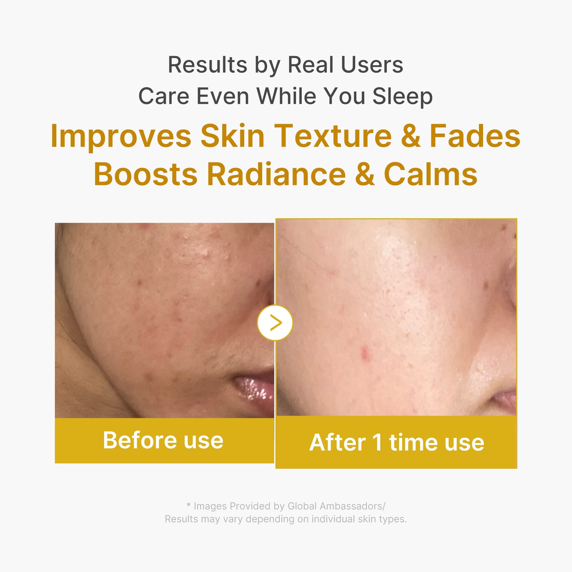 Kojic Acid Turmeric Overnight Wrapping Mask - medicube.us