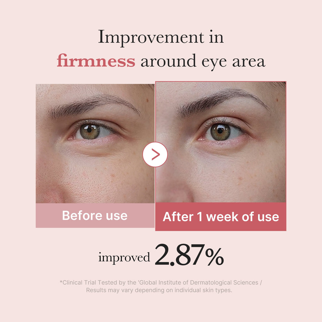PDRN Pink Peptide Eye Cream - medicube.us