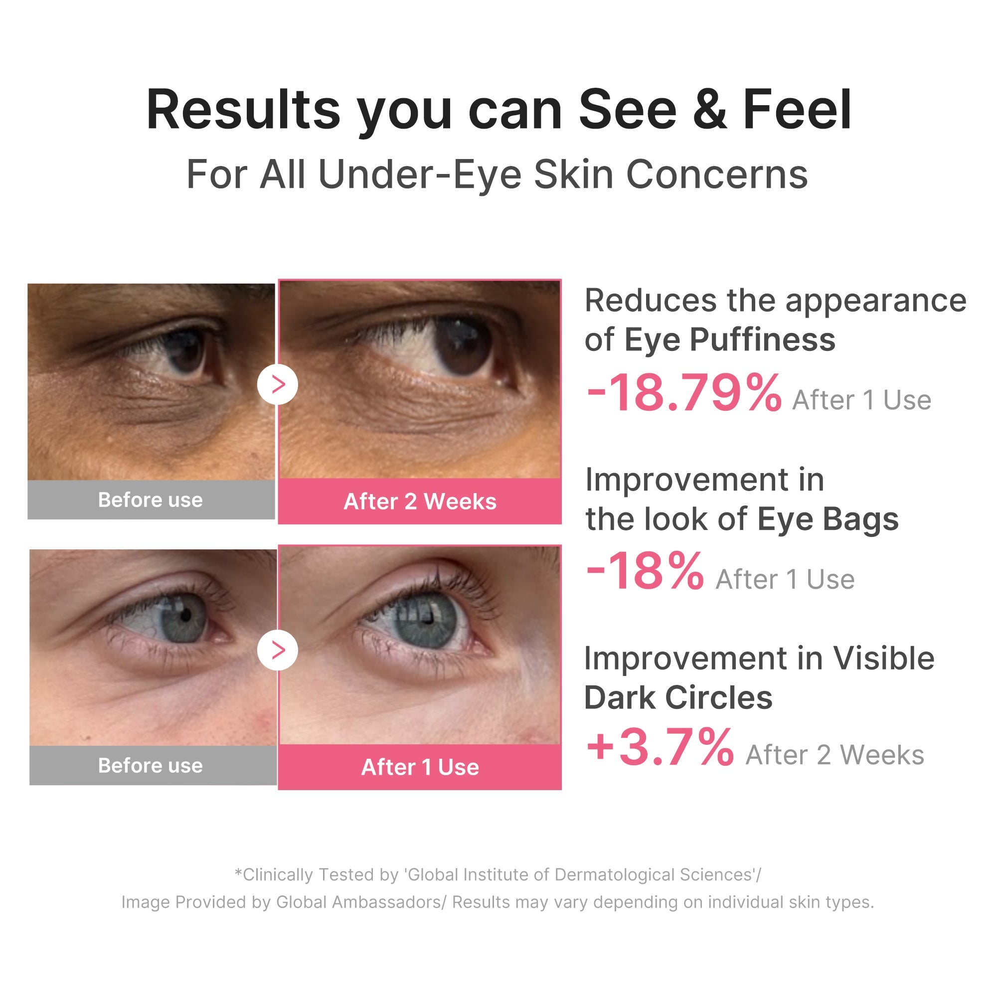 PDRN Caffeine Collagen Eye Patch KX41