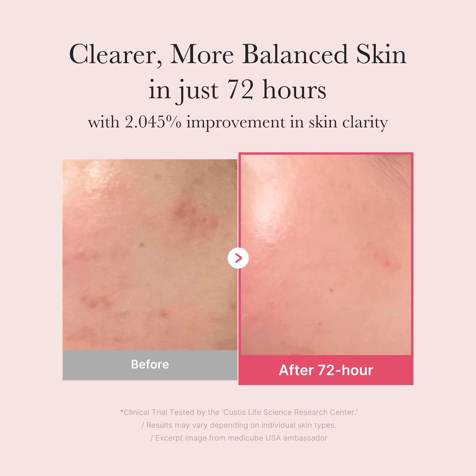 TXA Niacinamide Serum - medicube.us